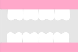 Image depicting dentures on gums. 